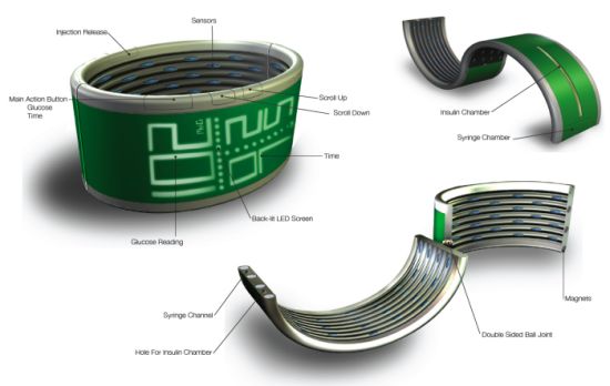 glucom wristband 2